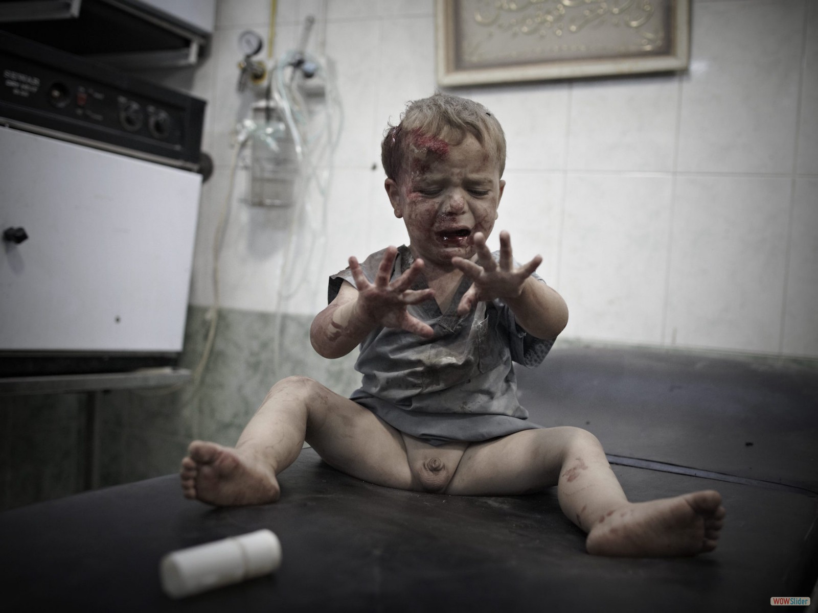 Un enfant blessé en attente de soins dans un des derniers hôpitaux encore debout à Alep. Les centres médicaux qui soignent les blessés dans les quartiers tenus par les rebelles semblent être la cible privilégiée des militaires, ce qui oblige les médecins à travailler dans un réseau clandestin de cliniques et de petits hôpitaux de campagne.
<br><i><b>

An injured child waiting for treatment in one of the last hospitals still standing in Aleppo. Medical centers treating casualties in rebel-held districts appear to have been specifically targeted by the military, forcing doctors to work from an undercover network of clinics and small field hospitals. </b></i>
