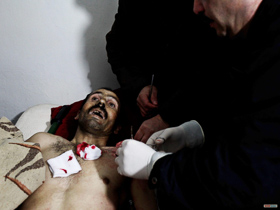  <p class='fr'>
	Quartier de Karm al-Zaytoun, janvier 2012. Les victimes de snipers et de bombe à clous affluent au petit dispensaire improvisé (deux pièces). Un jeune homme, une balle en pleine tête, est amené en urgence. Puis cet homme touché à la poitrine. Puis une femme grièvement blessée à la mâchoire, les yeux remplis d’effroi. Puis un homme victime d’une bombe à clous. Et encore trois hommes, également victimes d’une bombe à clous lancée près d’un autre centre de santé. Malgré les efforts des infirmiers, trois blessés perdront la vie.
	</p> <p class='en'>
	Karm al-Zaytoun neighborhood, January 2012.

Victims of sniper fire and nail bomb attacks poured into the makeshift two-room medical center. A young man shot in the head was given emergency treatment; this man had been hit in the chest; then a woman with a serious wound to the jaw, staring in horror; next a man injured by a nail bomb that went off near a different healthcare center. The nurses did what they could, but three of the victims died. Karm al-Zaytoun neighborhood, January 2012.

Victims of sniper fire and nail bomb attacks poured into the makeshift two-room medical center. A young man shot in the head was given emergency treatment; this man had been hit in the chest; then a woman with a serious wound to the jaw, staring in horror; next a man injured by a nail bomb that went off near a different healthcare center. The nurses did what they could, but three of the victims died.
	</p>