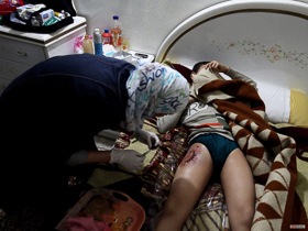  <p class='fr'>
	Quartier de Khalidiya, novembre 2011. Ahmed, 15 ans, blessé à la jambe par le tir d’un sniper alors qu’il allait faire une course. La rue était calme, Ahmed n’a pas pressenti le danger. Il reçoit les premiers soins d’une aide-soignante avant d’être emmené dans un hôpital privé, où sont envoyés uniquement les cas graves. Les hôpitaux publics ne sont pas accessibles en raison des risques d’arrestation.
	</p> <p class='en'>
	Khalidiyya neighborhood, November 2011.

Ahmed (15) was hit in the leg by sniper fire while going shopping. The street was quiet and Ahmed had not sensed any danger. He is being treated by a nursing aide and will then be taken to a private hospital which only deals with serious cases. Public hospitals are not used because of the risk of being arrested.
	</p>