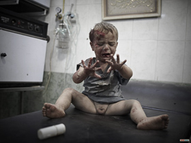 <p class='fr'>
	Un enfant blessé en attente de soins dans un des derniers hôpitaux encore debout à Alep. Les centres médicaux qui soignent les blessés dans les quartiers tenus par les rebelles semblent être la cible privilégiée des militaires, ce qui oblige les médecins à travailler dans un réseau clandestin de cliniques et de petits hôpitaux de campagne.
	</p> <p class='en'>
	An injured child waiting for treatment in one of the last hospitals still standing in Aleppo. Medical centers treating casualties in rebel-held districts appear to have been specifically targeted by the military, forcing doctors to work from an undercover network of clinics and small field hospitals.
	</p>