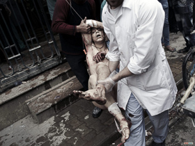  <p class='fr'>
	Un civil gravement blessé est transporté vers l’hôpital Dar al-Shifa, avant d’être évacué en Turquie pour y recevoir des soins médicaux vitaux.

	</p> <p class='en'>
	A civilian with severe wounds is taken from Dar al-Shifa hospital to be sent to Turkey for life-saving treatment.

	</p>