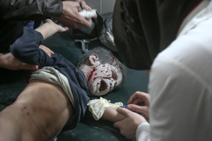  <p class='fr'>
	Un garçon blessé lors d’un bombardement imputé aux forces gouvernementales est soigné dans un hôpital de fortune. Hamouria, 5 mars 2018.

	</p> <p class='en'>
	A wounded boy in a bombing reported to be by government forces is being treated at a makeshift hospital. Hamouria, March 5, 2018.
	</p>